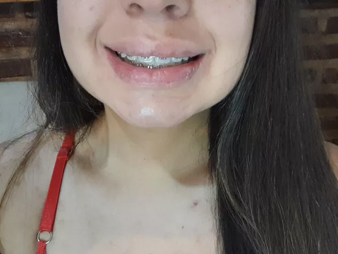 I love showing off my braces
