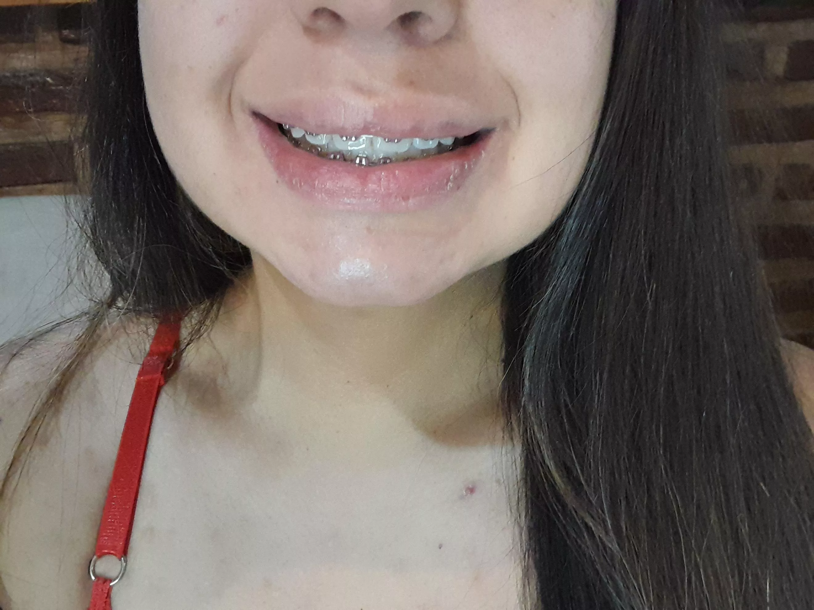 I love showing off my braces