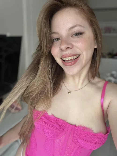 I'm very attractive with braces. You agree?