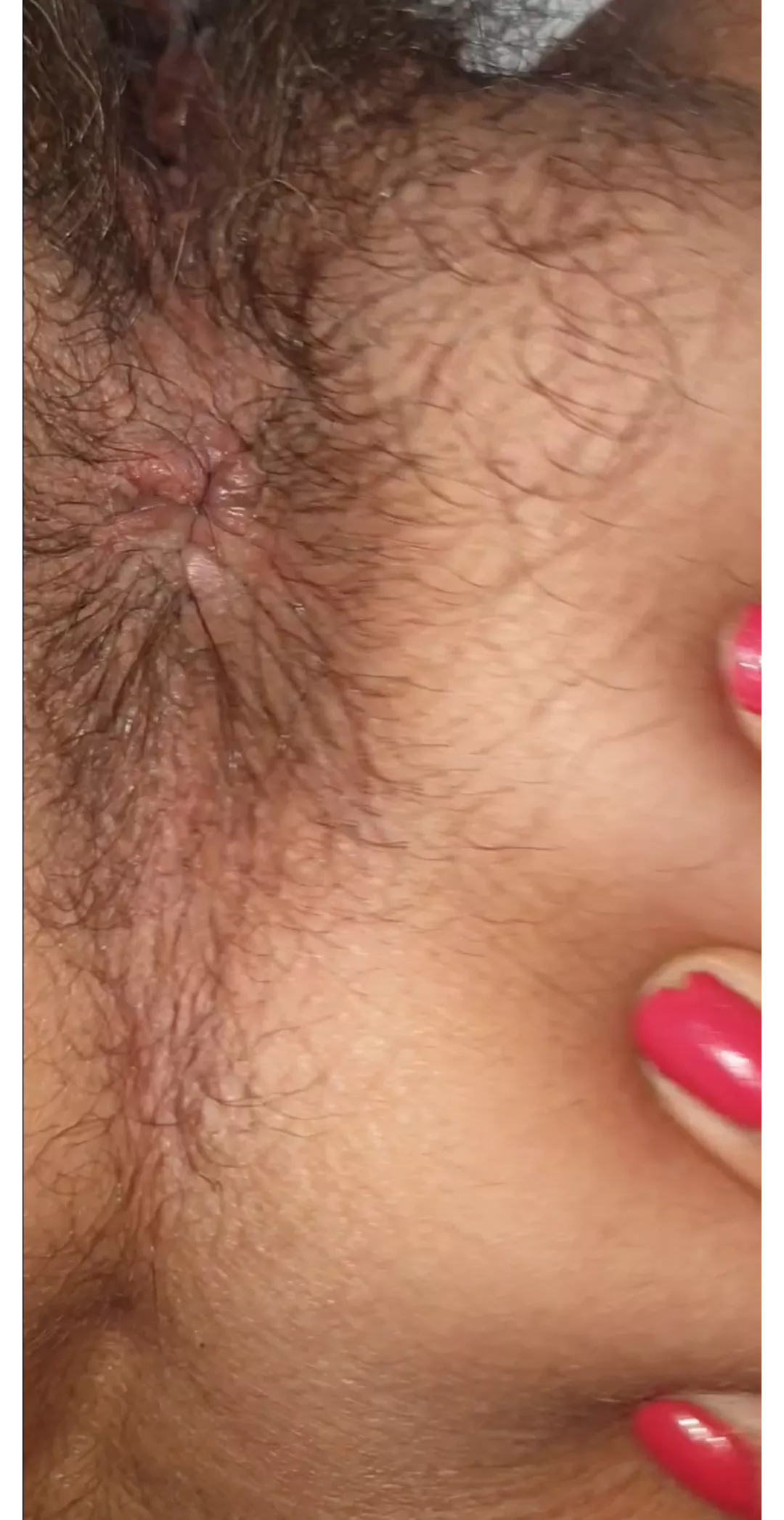 Asshole-icious..Don't you agree...yes or no...