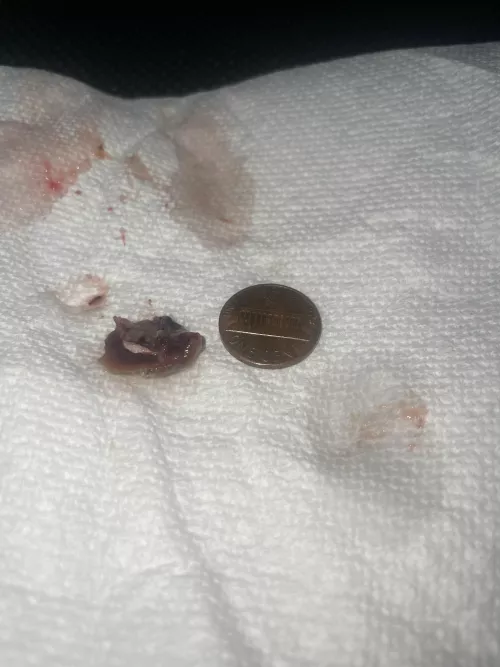 Don’t look if you get grossed out easy 