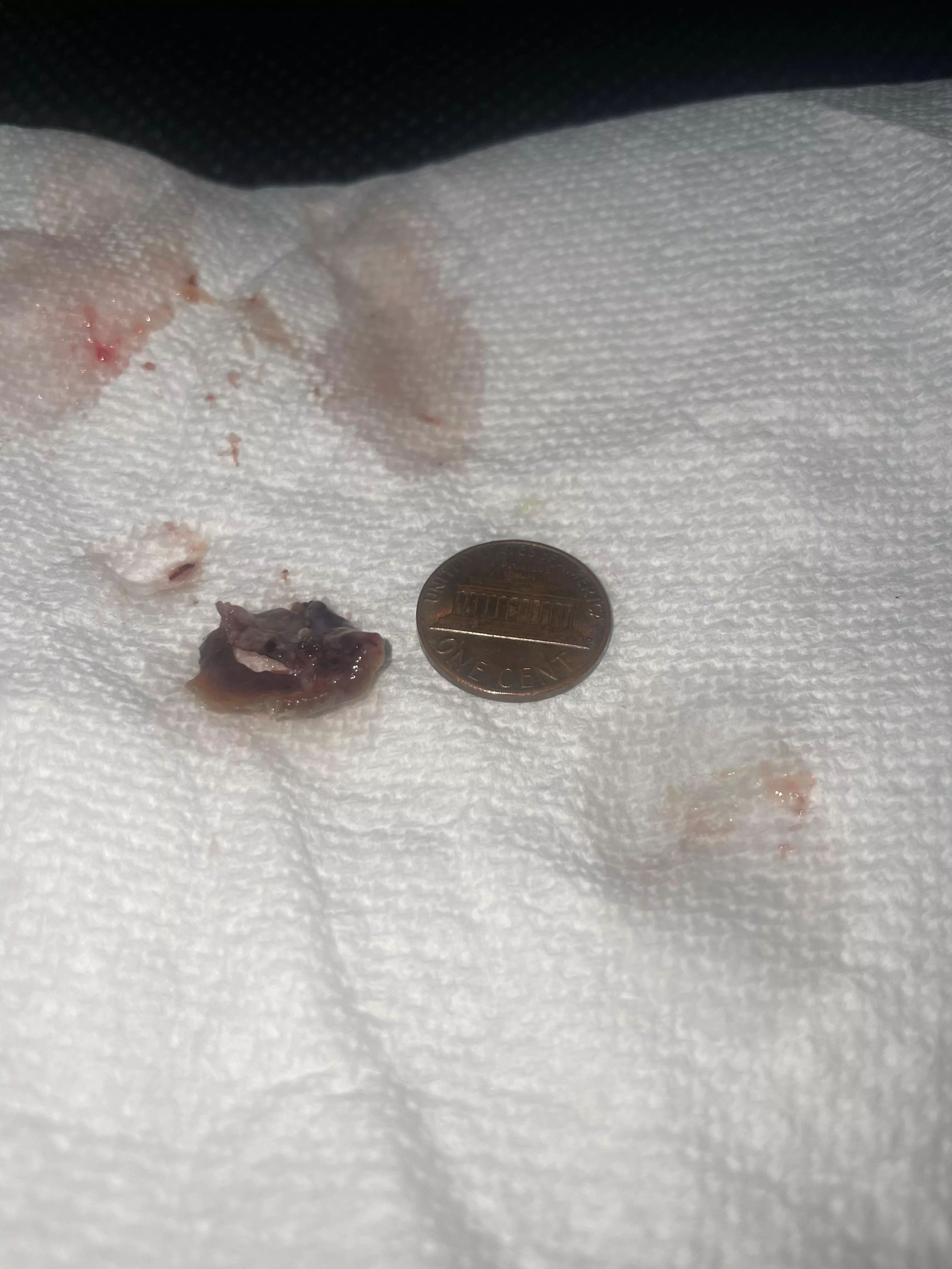 Don’t look if you get grossed out easy 