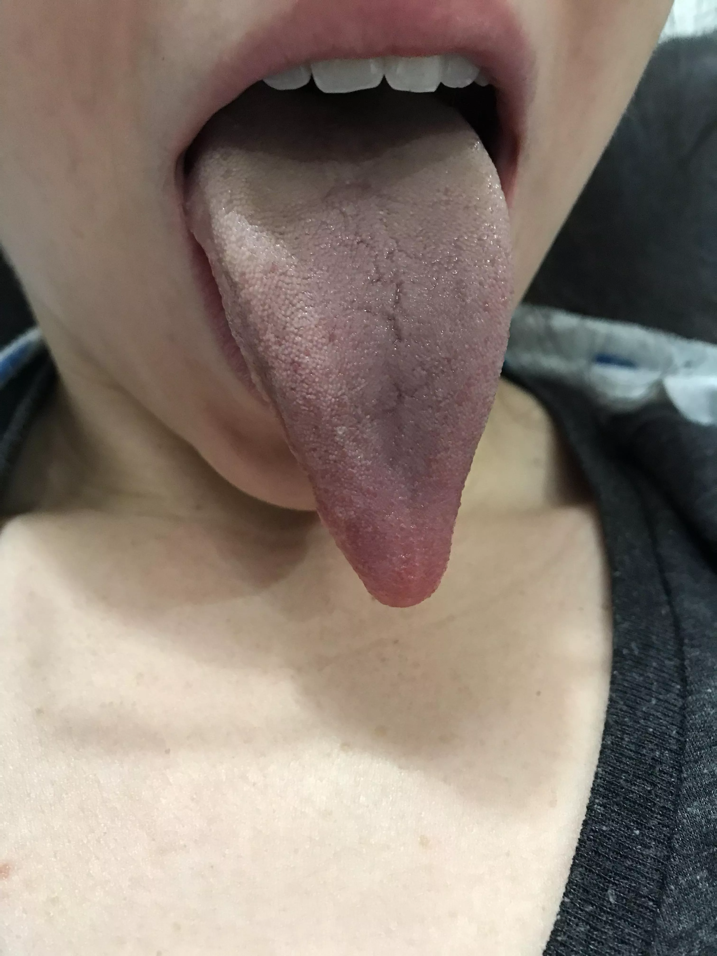 Do you like my tongue? 😜