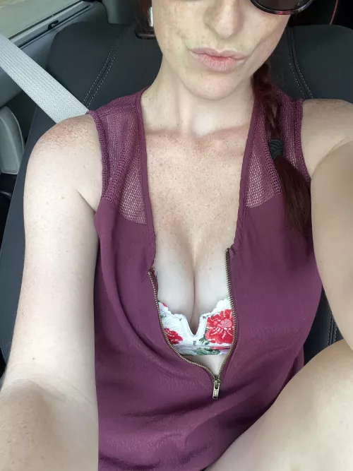 Freckles for days [f]