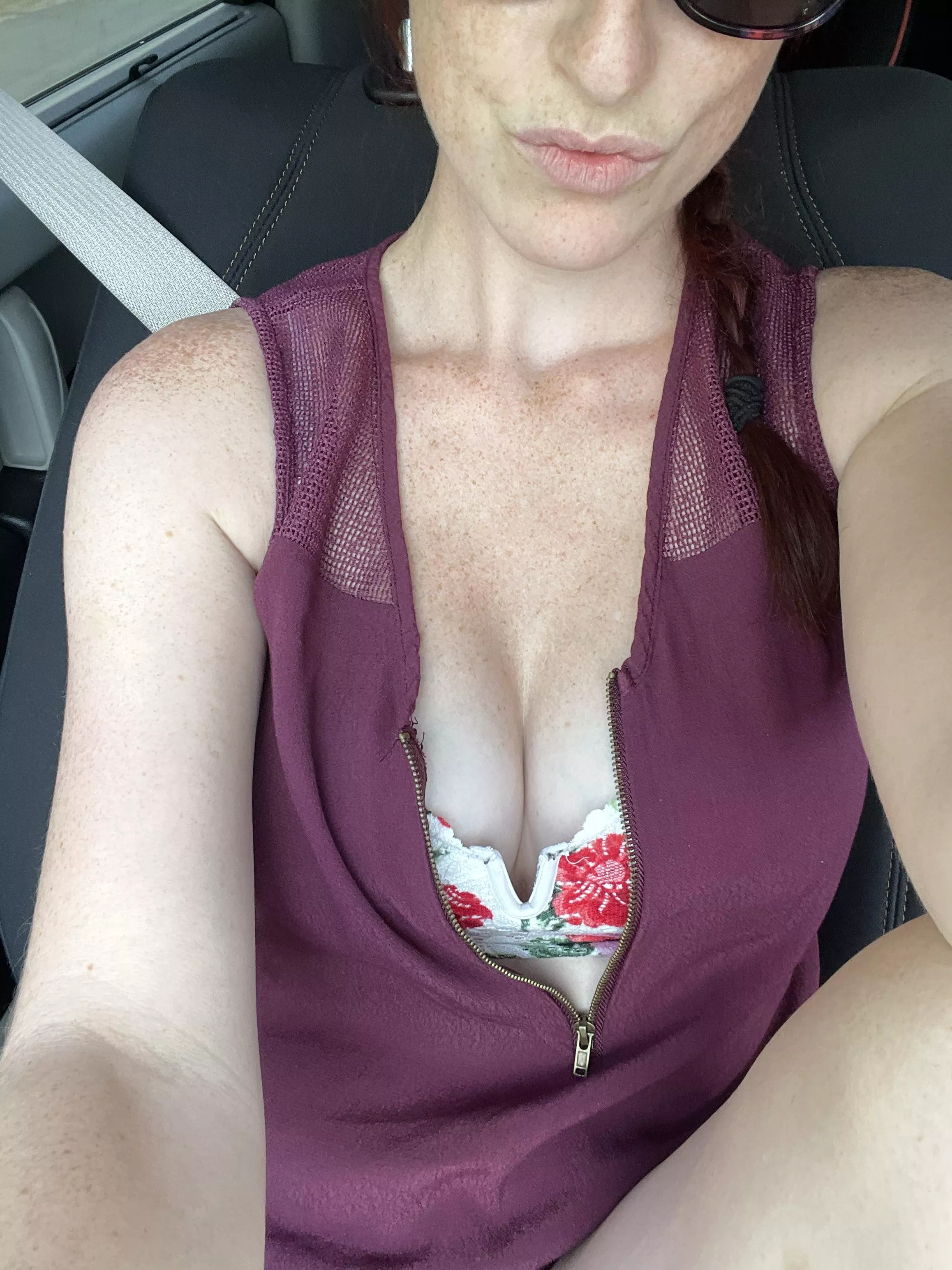 Freckles for days [f]