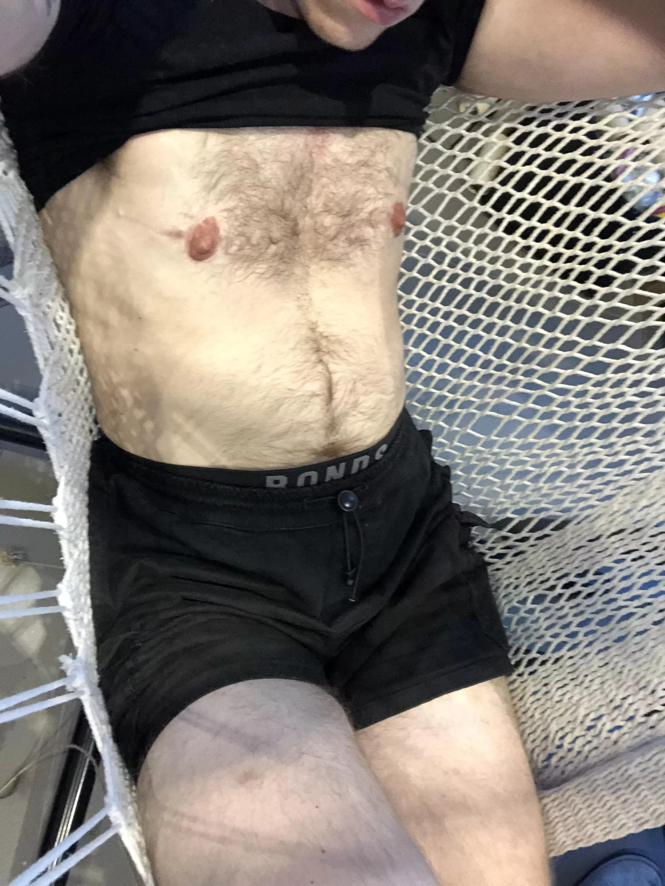 ftm in melbourne, australia