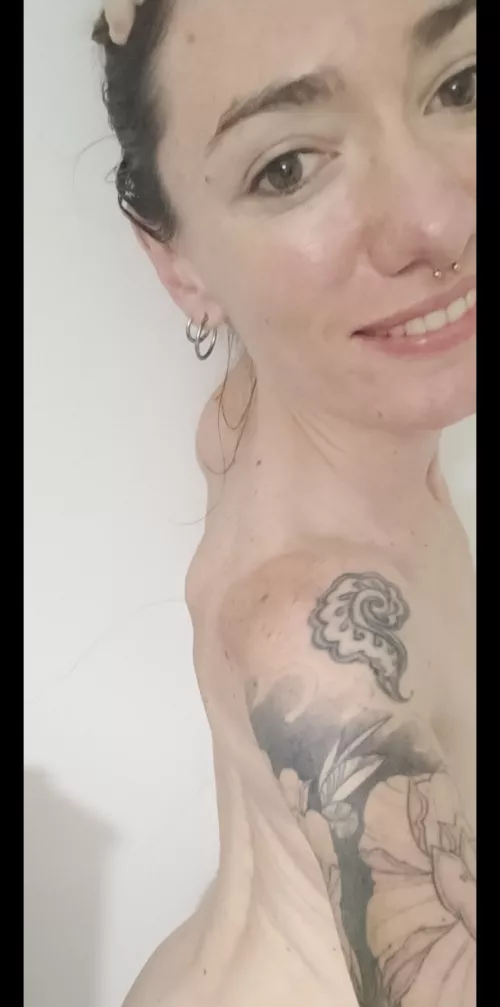 I have moles in my eyes too!!