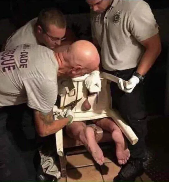 Naked Florida man gets his balls stuck in a plastic chair, ouch.