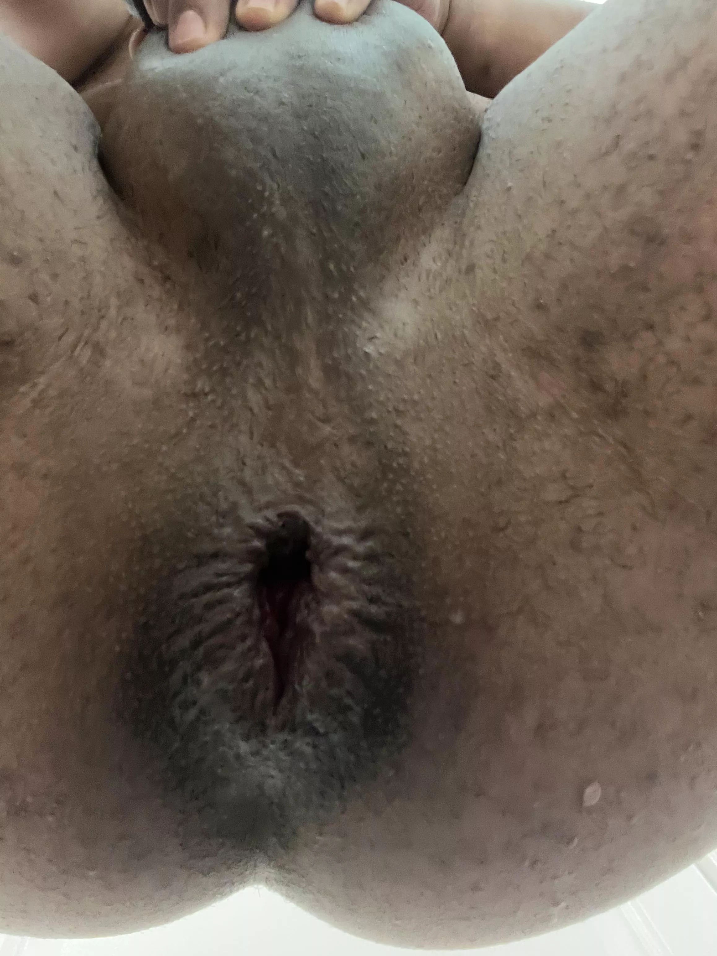 The new normal of my hole