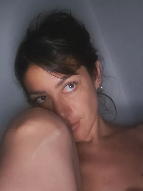 Do you remember those scars on your leg?