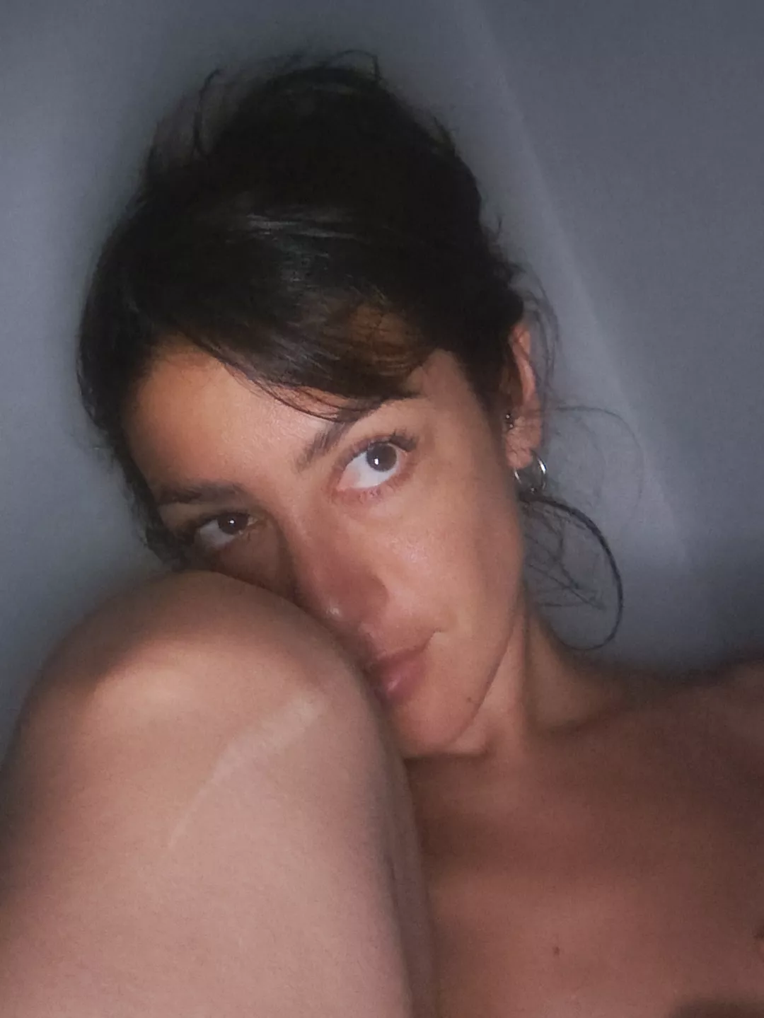 Do you remember those scars on your leg?