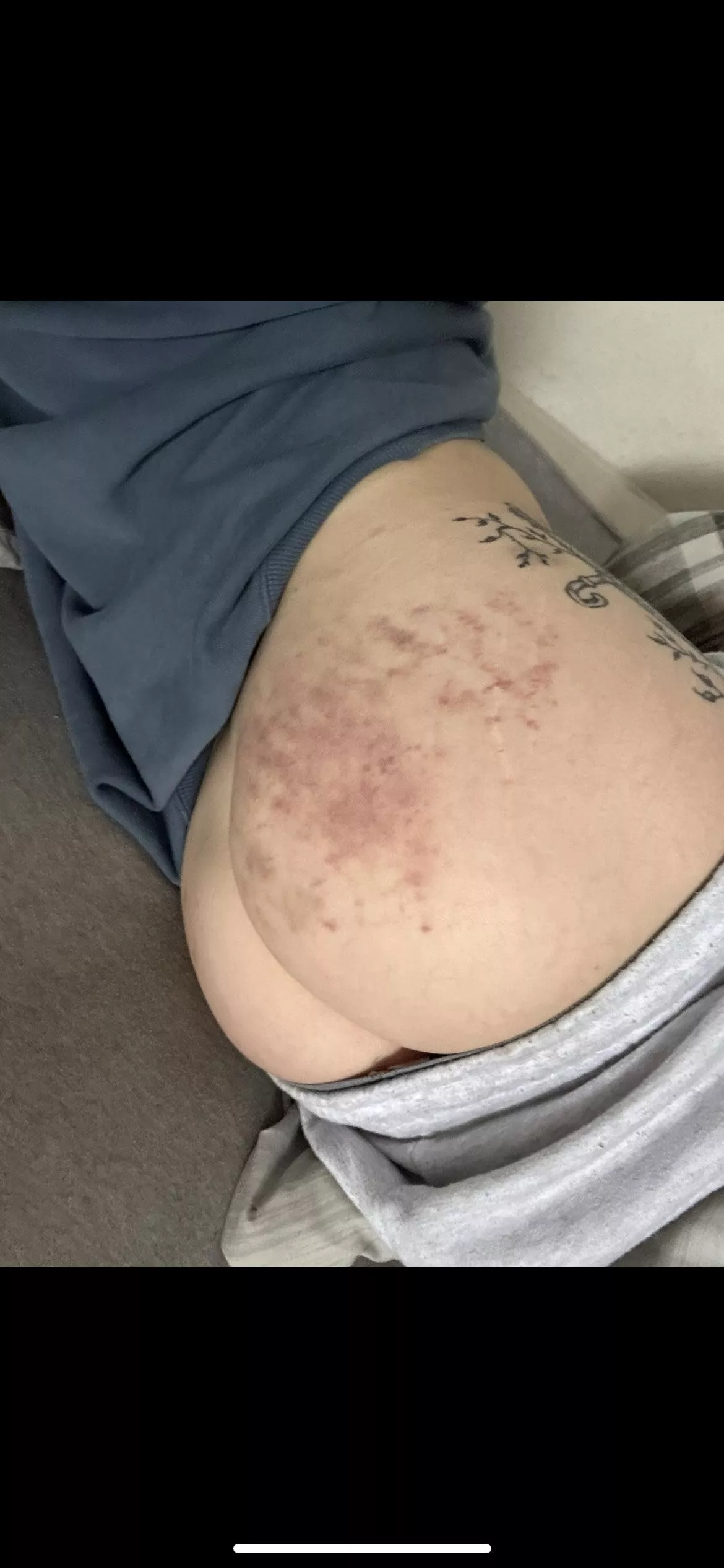 Slowly healing from my spanking 