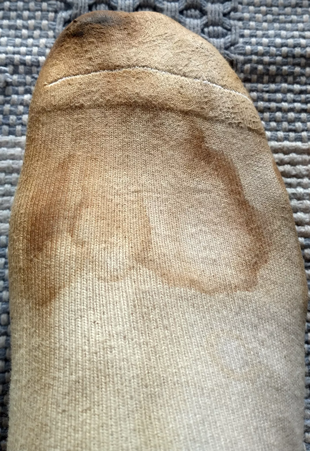 Who else loves casually seeing such stains when someone is wearing their socks?