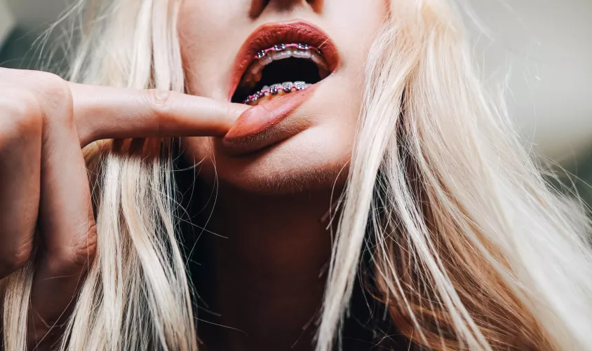 Pretty pink lips, plus pink braces