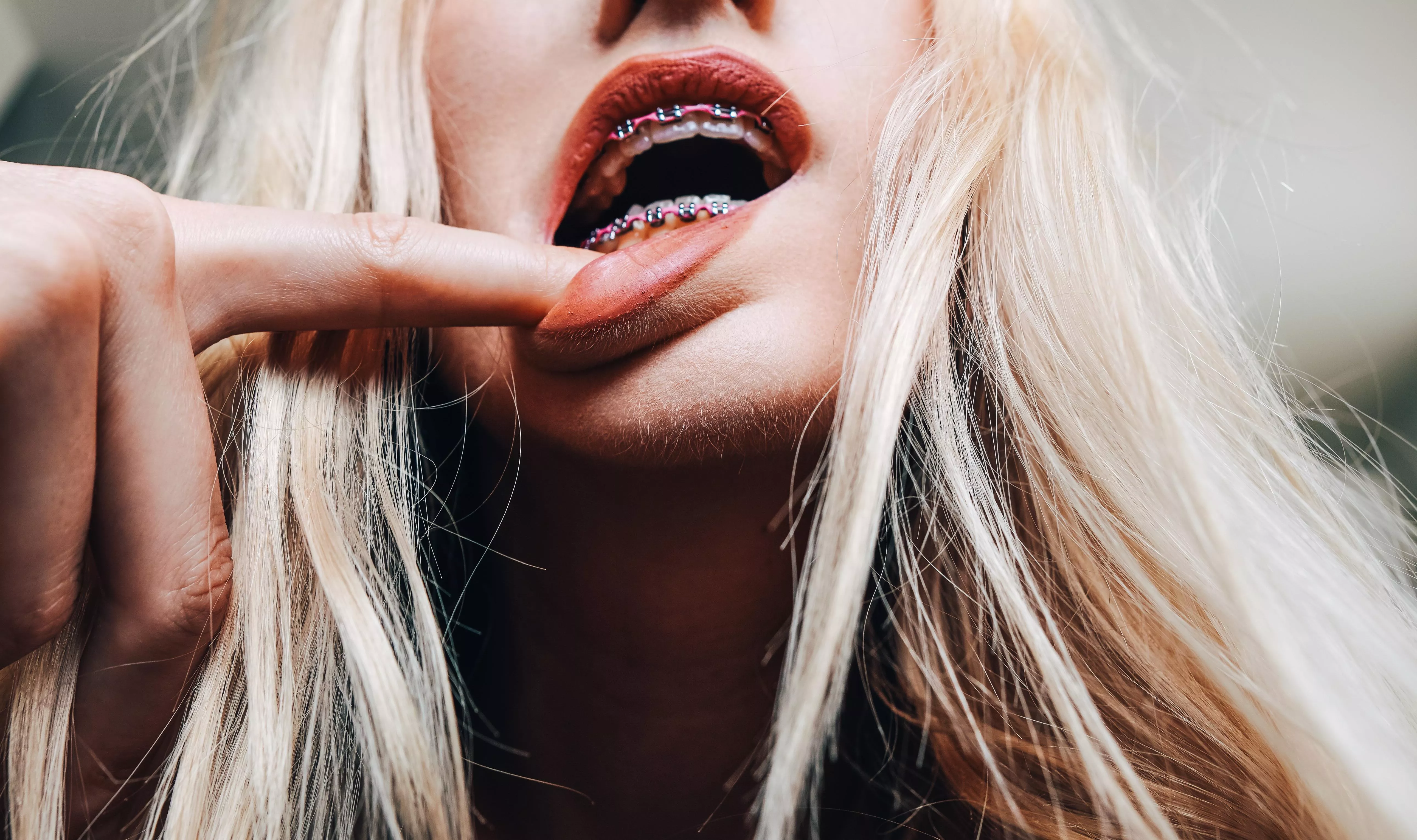 Pretty pink lips, plus pink braces