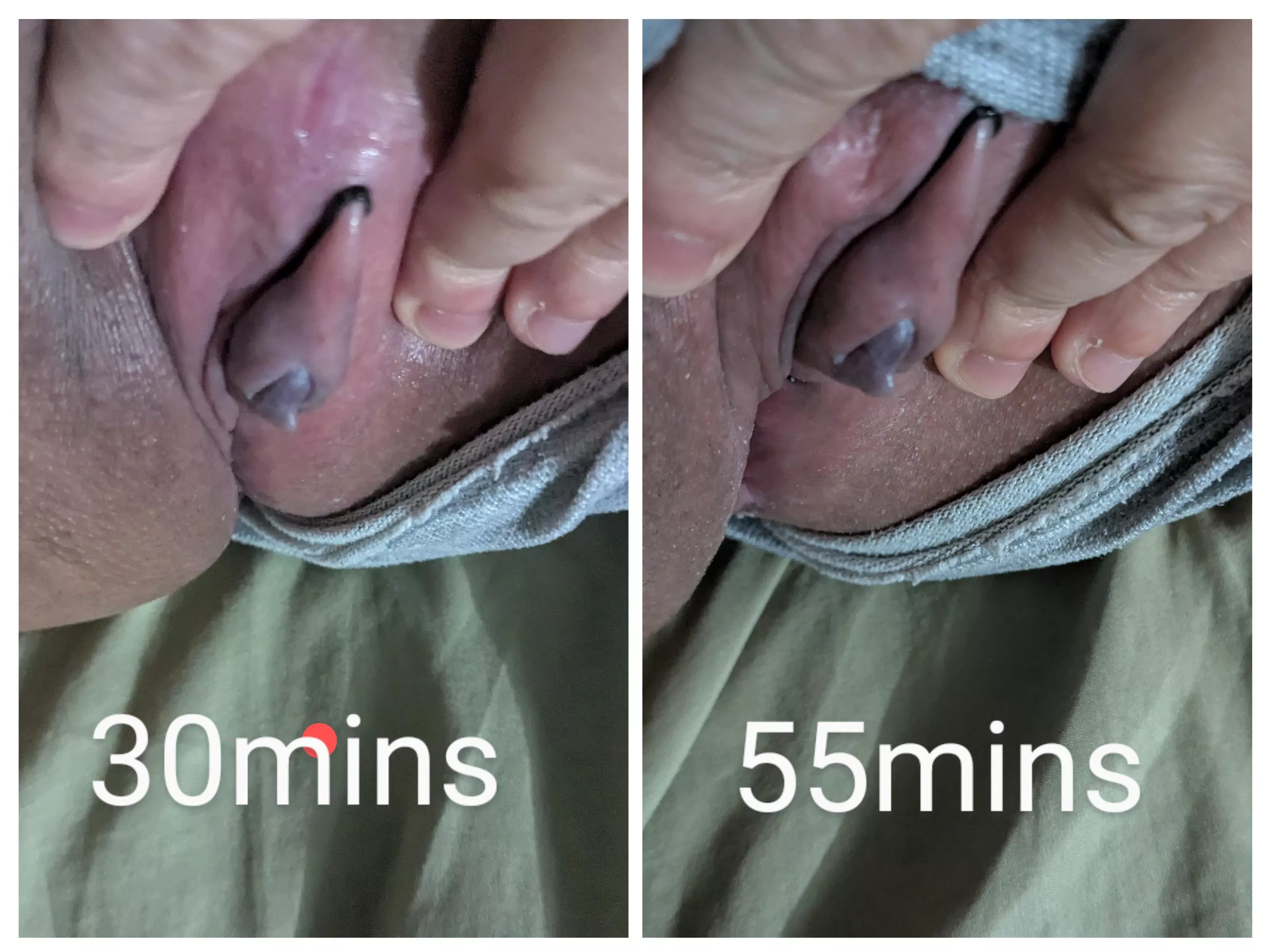 Strangled my useless clit