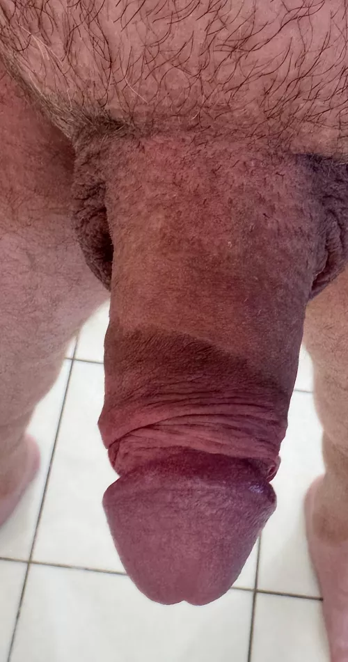 The scar never lets me forget what I’m missing