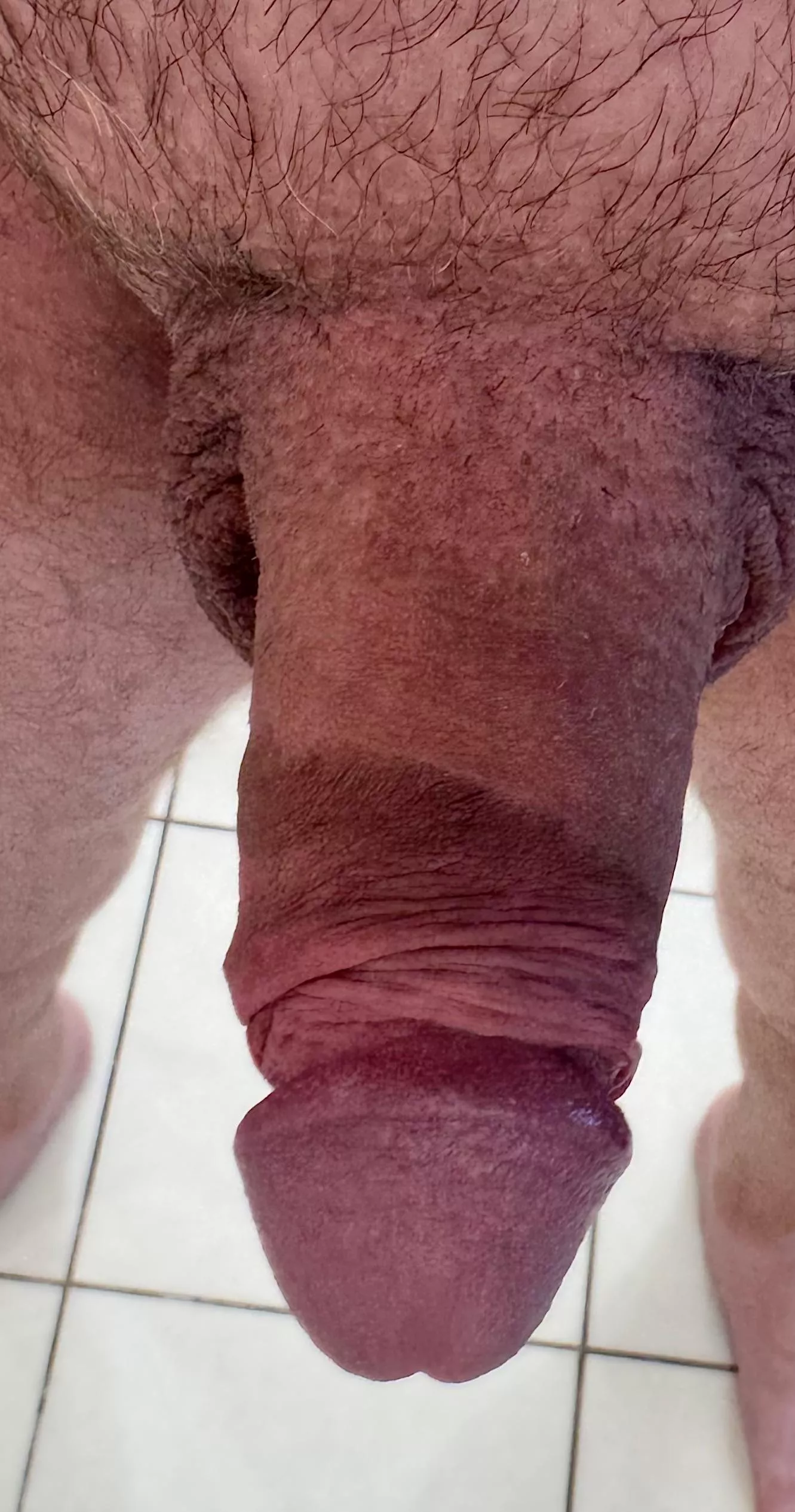 The scar never lets me forget what I’m missing