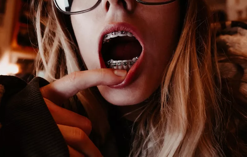 What’s better than braces? Braces AND glasses