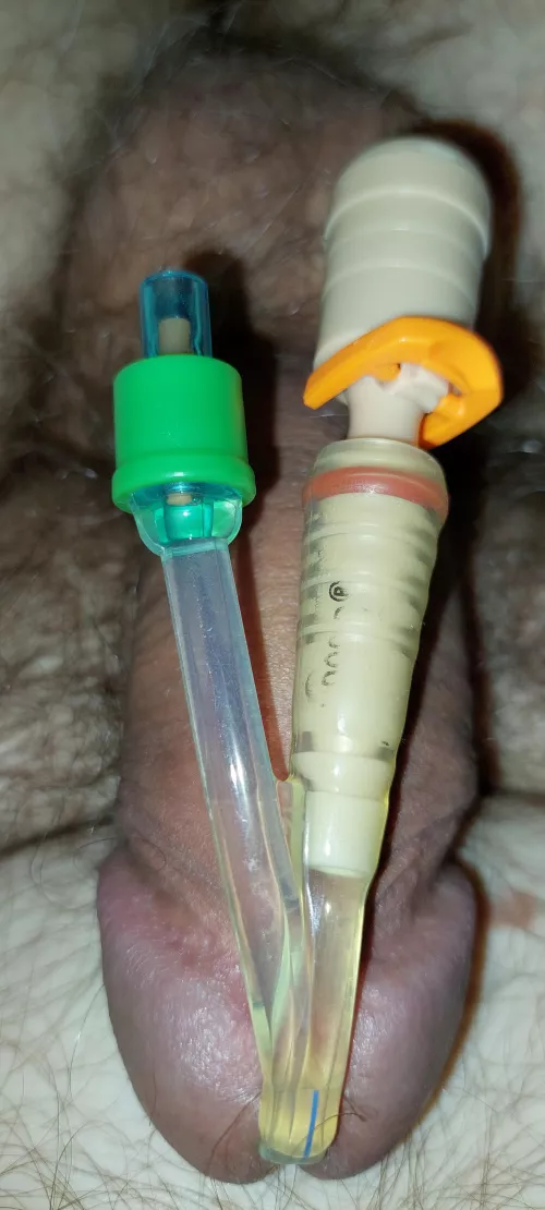 Anal sex with installed silicone long-term foley catheter 