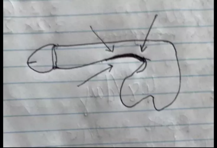 Dent at the base of the CS. I also feel as this contributes to my downward curve. 