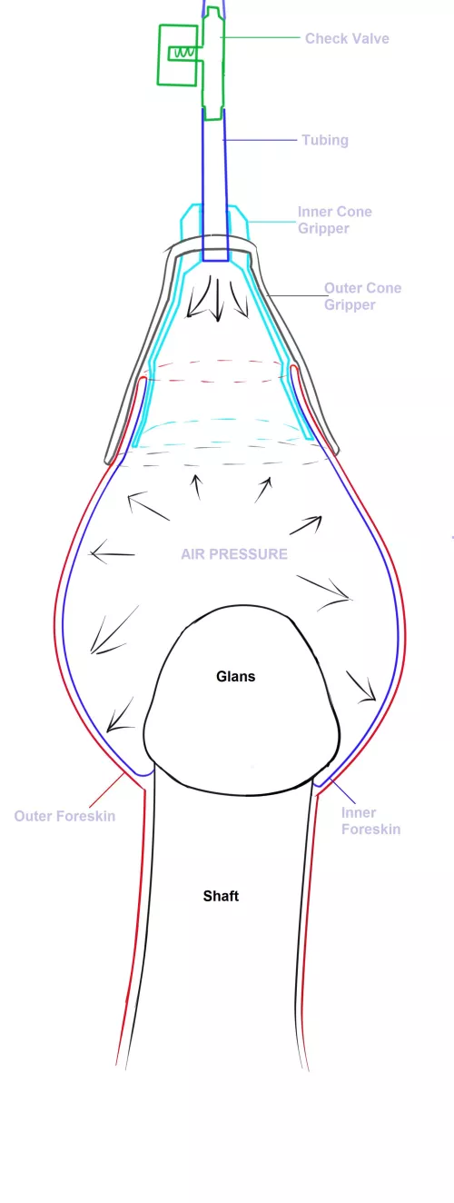 HRDA Inflation Diagram
