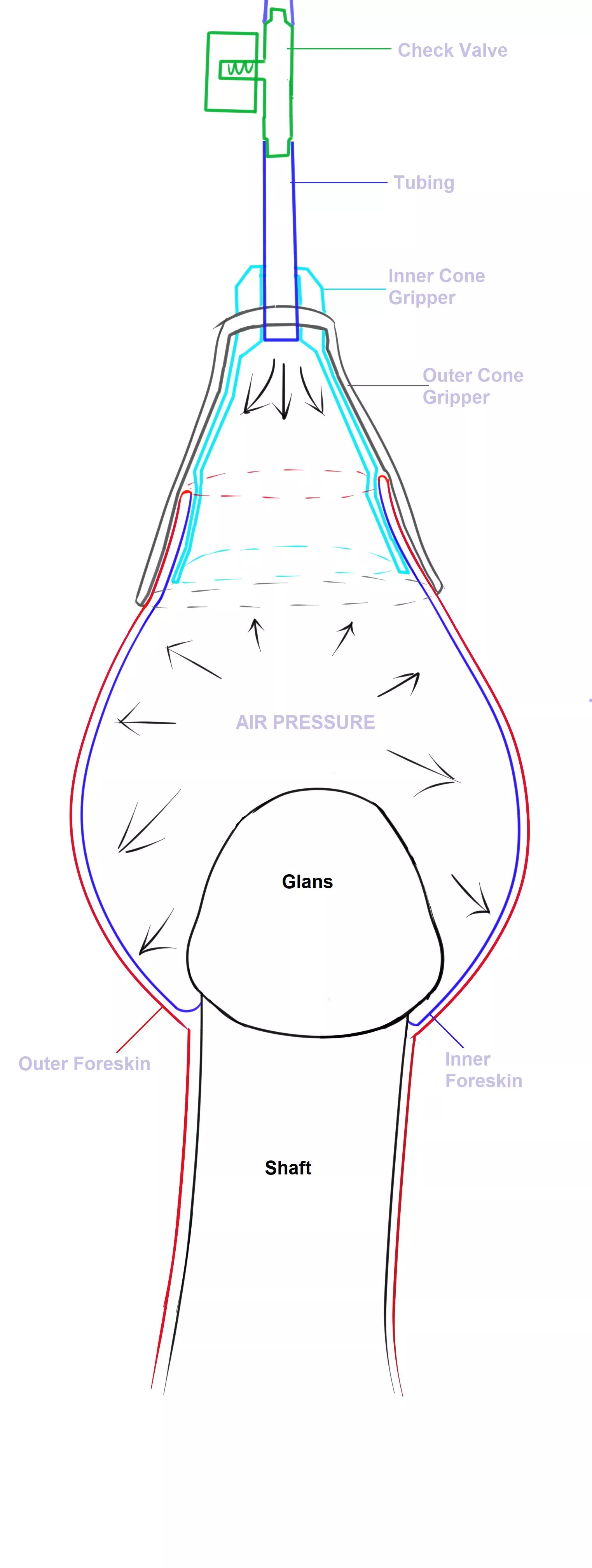 HRDA Inflation Diagram