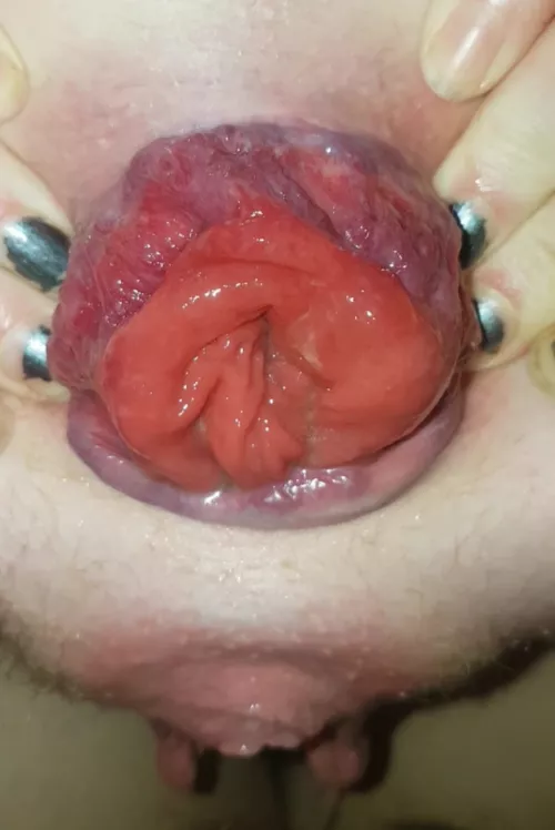 I love seeing how much I've damaged my asshole from playing with it