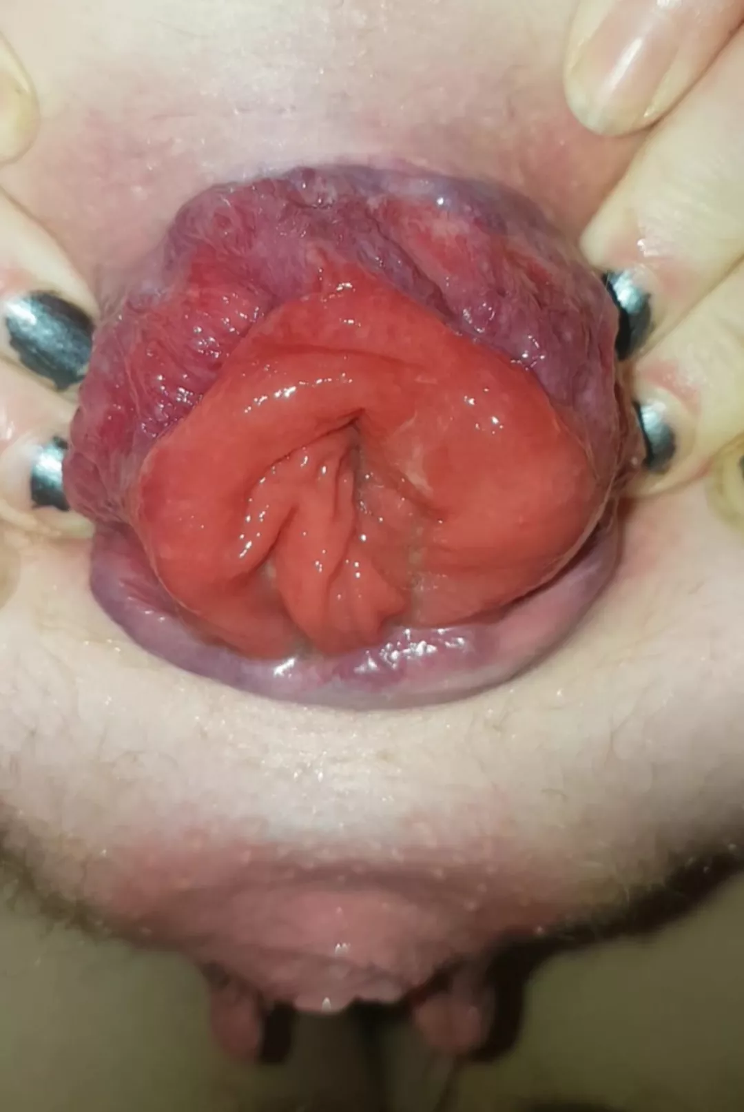 I love seeing how much I've damaged my asshole from playing with it