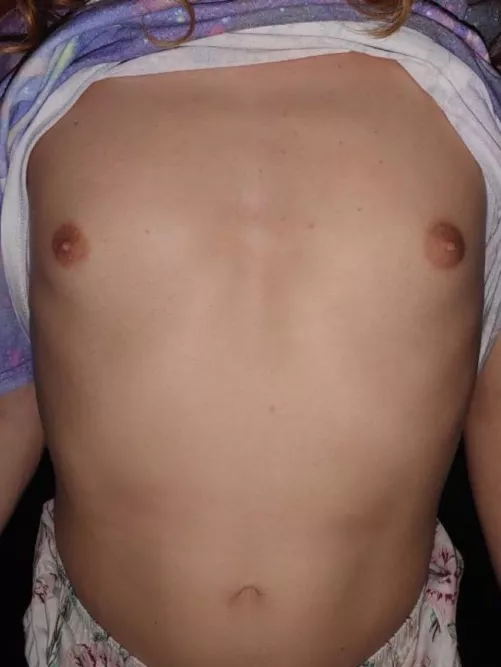 Any other wide ribcage gals? 