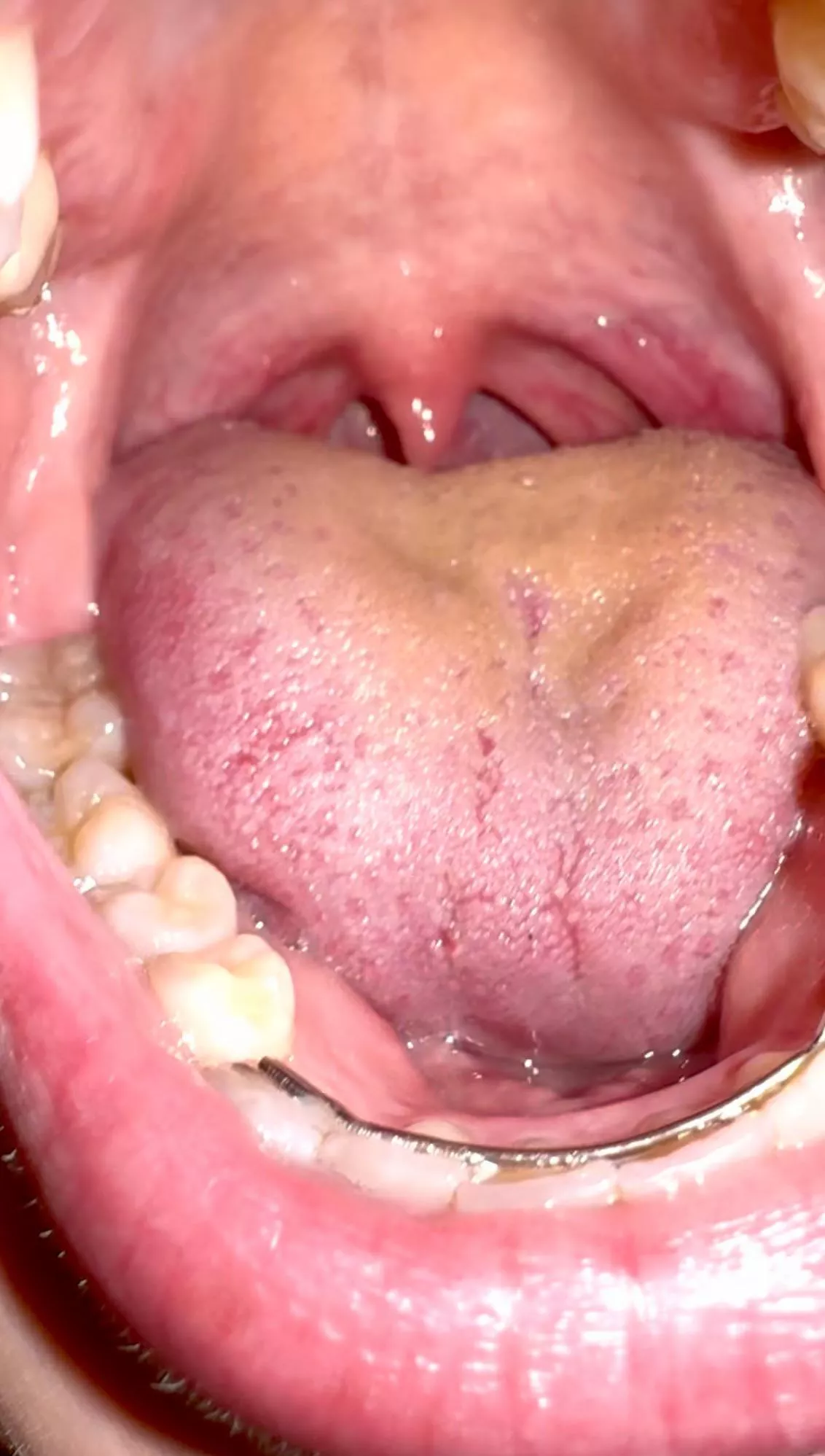 Ready to slide down?