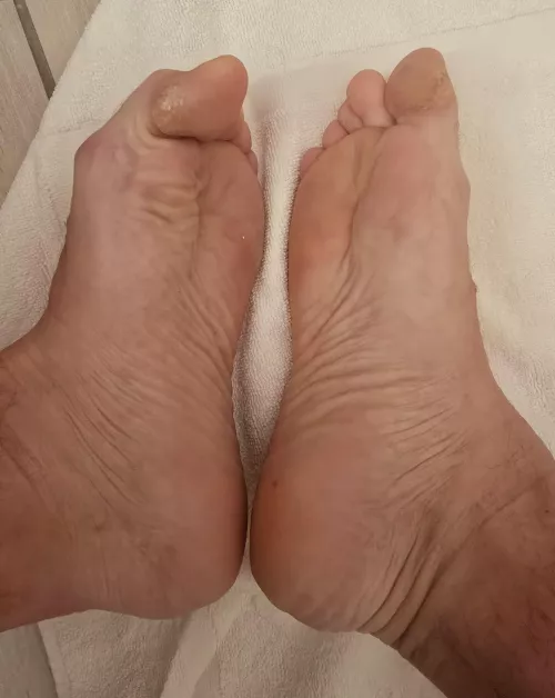 Sore Feet