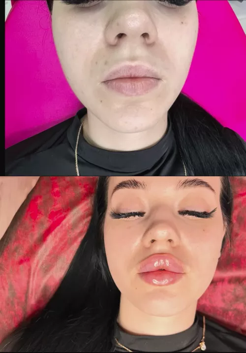 Siberian before/after