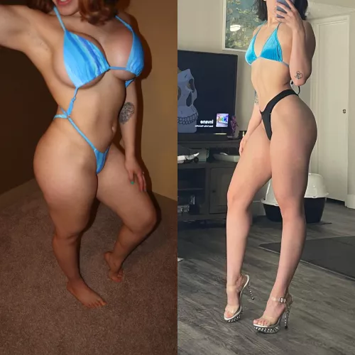 2 months post op 🩵