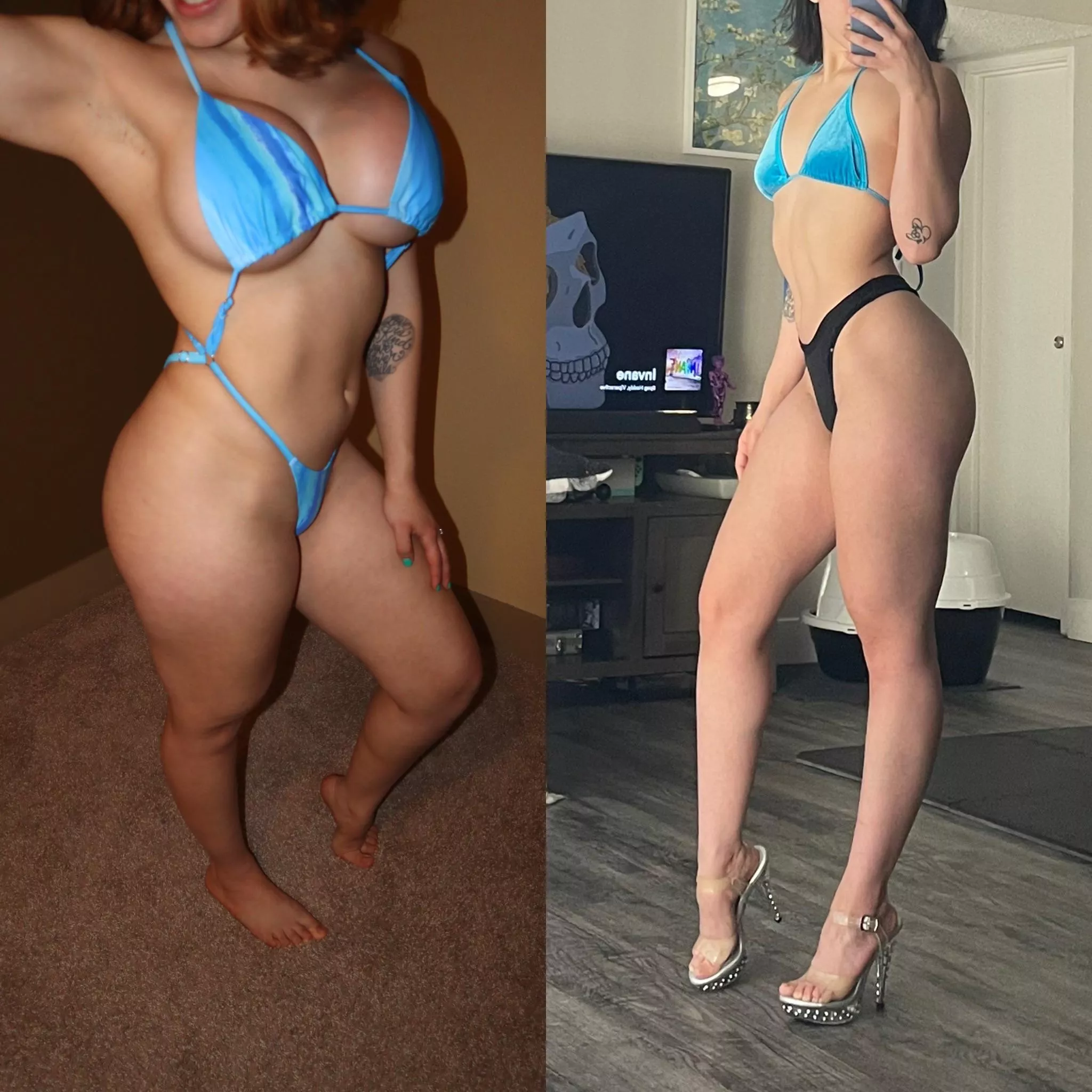 2 months post op 🩵