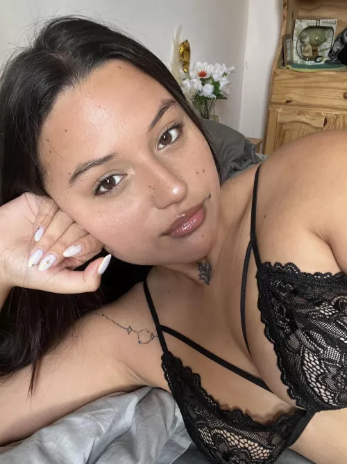 Are her moles distracting you?