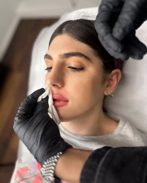 Finally lip fillers! What else should I get done?