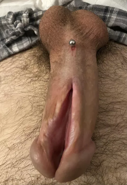 Reroute-Piercing is healing well