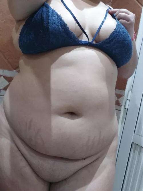 Can you describe my stretch marks? Please 