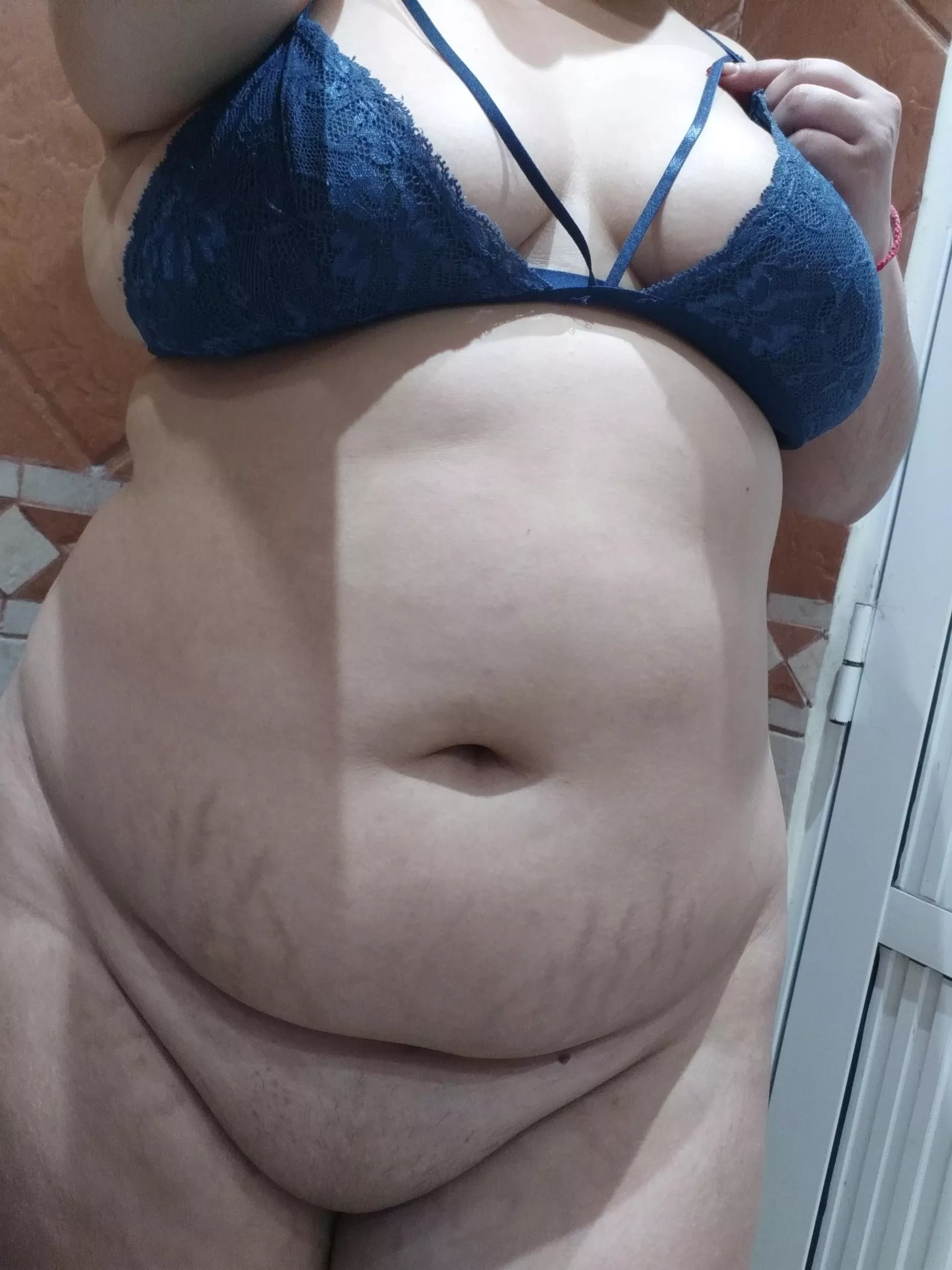 Can you describe my stretch marks? Please 