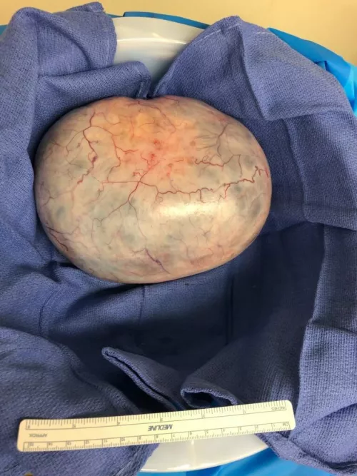 3 year anniversary of getting this thing out!