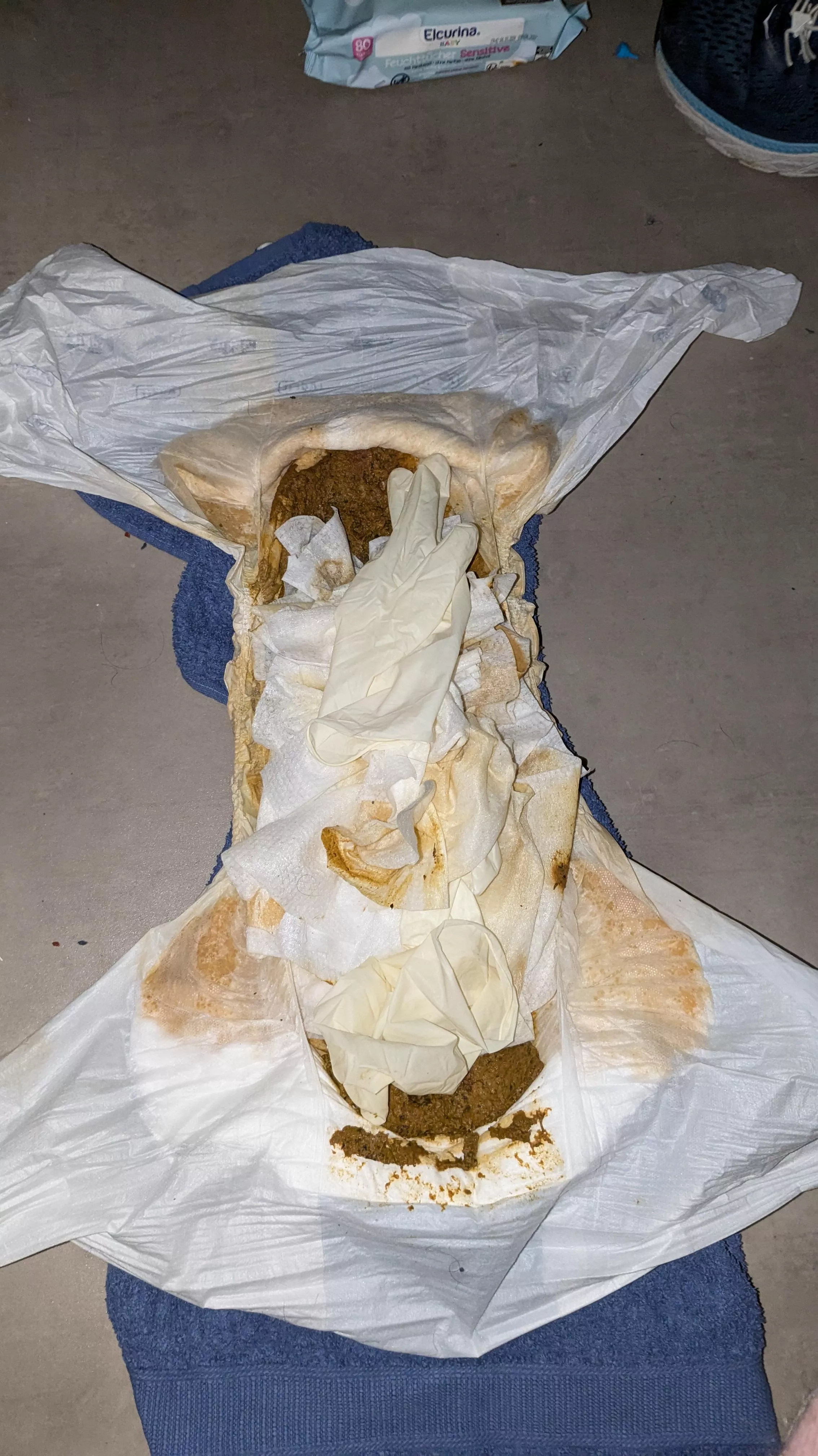 An accident and it's result