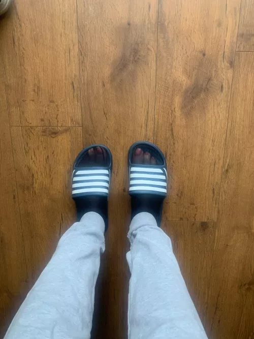 Didn’t realise they was so noticeable, just hope my gf family don’t notice 🤭