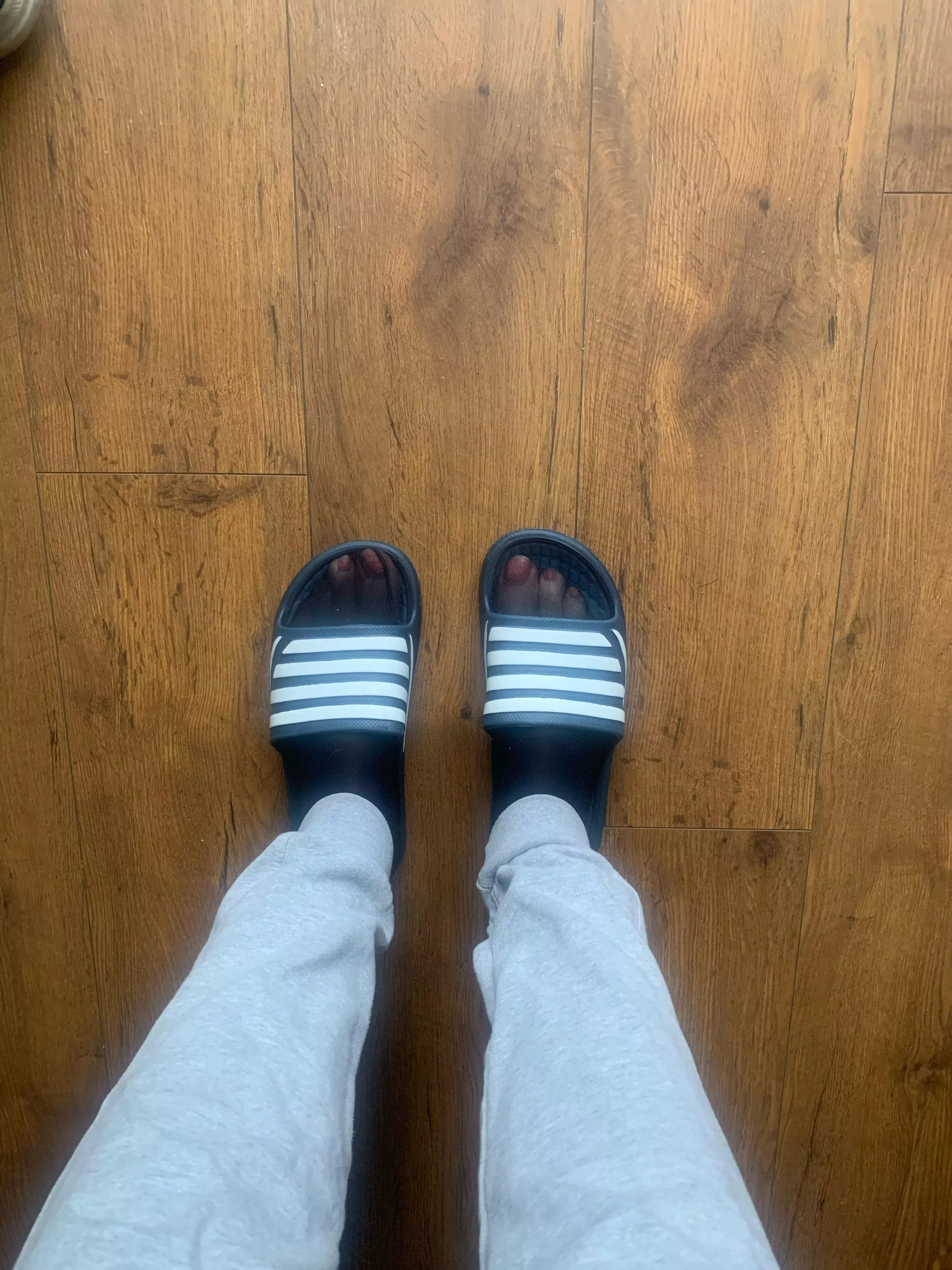 Didn’t realise they was so noticeable, just hope my gf family don’t notice 🤭