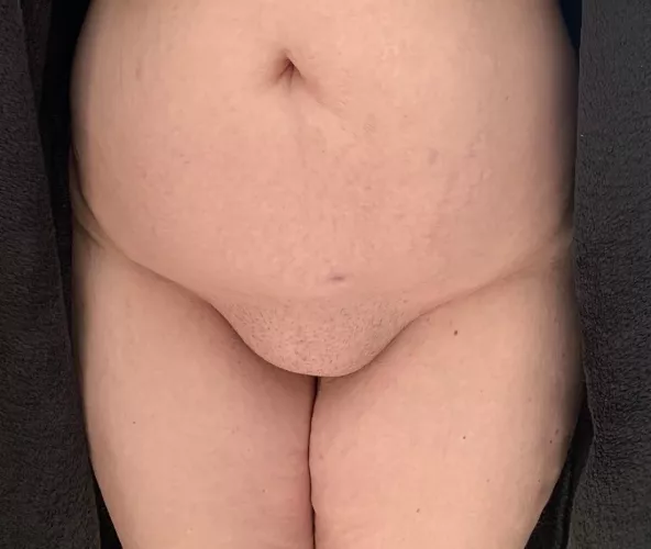 Anyone else love the fupa on my wife?