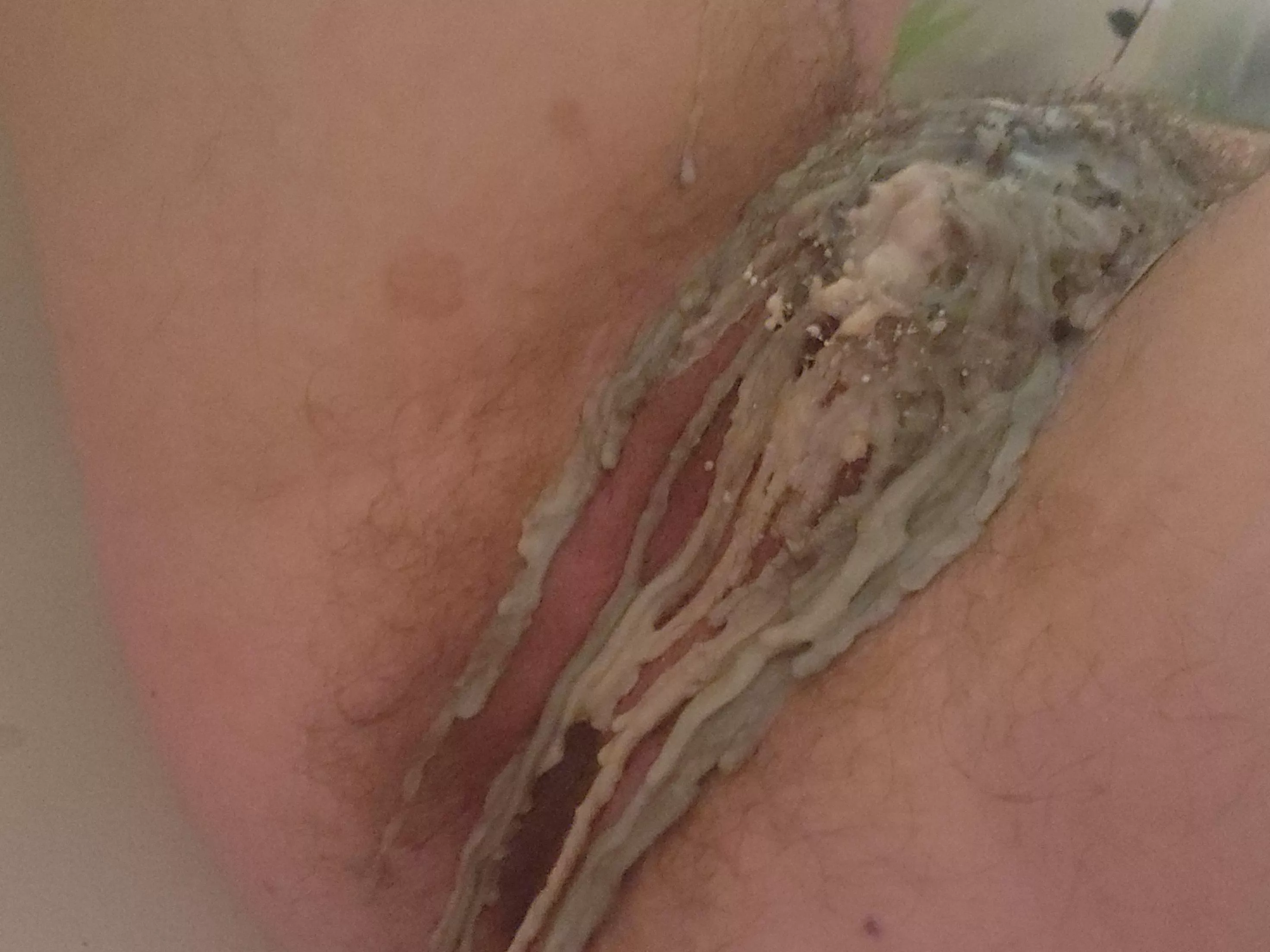 hurting my sensitive bits