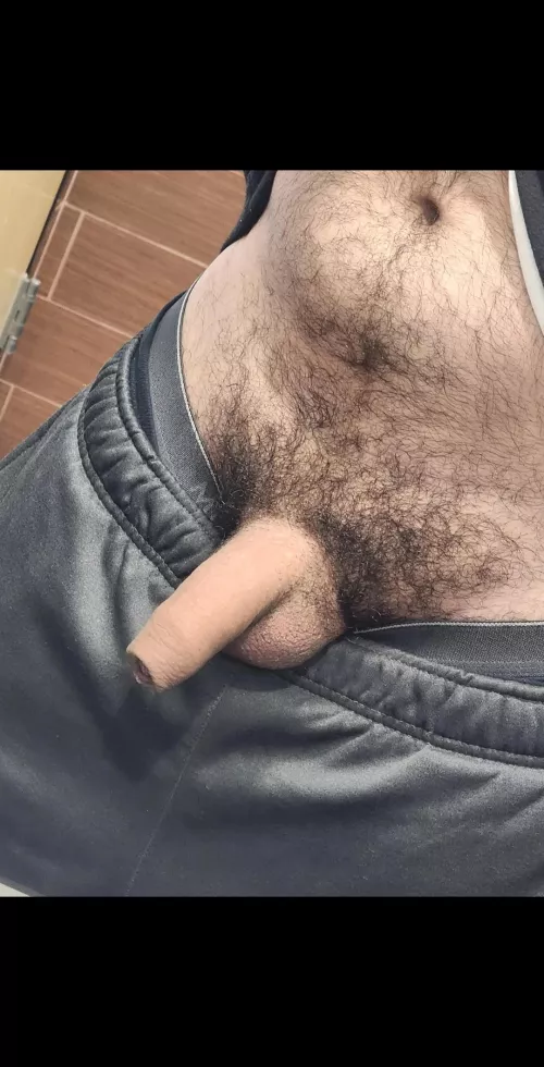 Is it un-American to have a foreskin? 