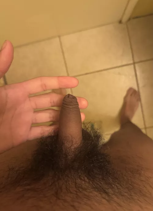 My foreskin