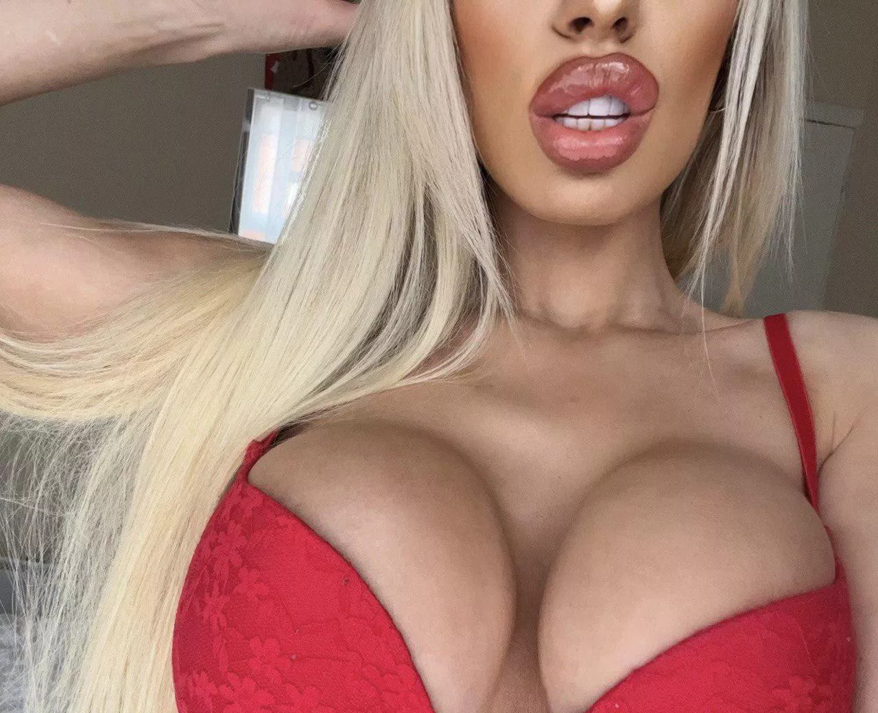 Bimbo lips always need upgrading