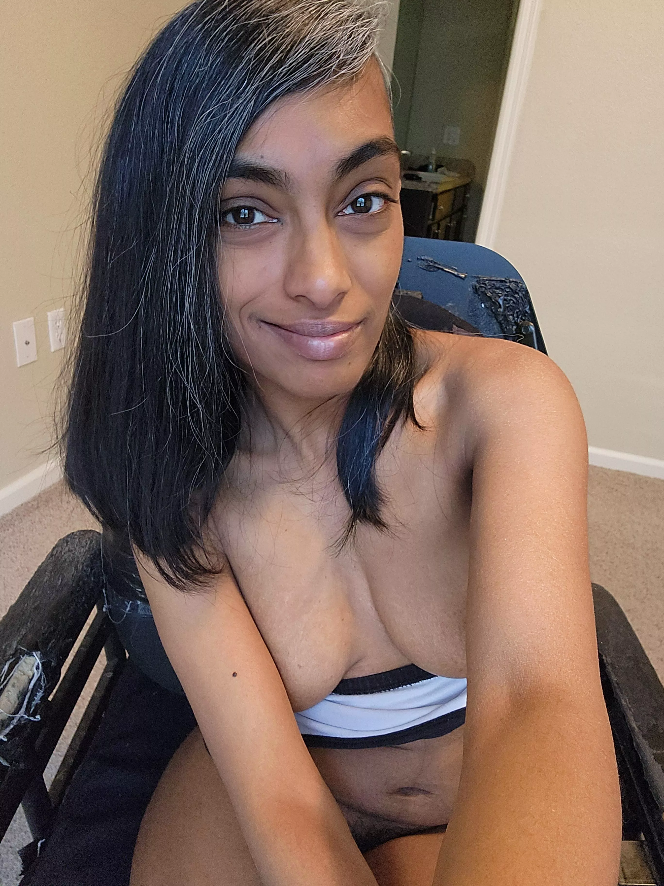 Cerebral palsy and scoliosis 